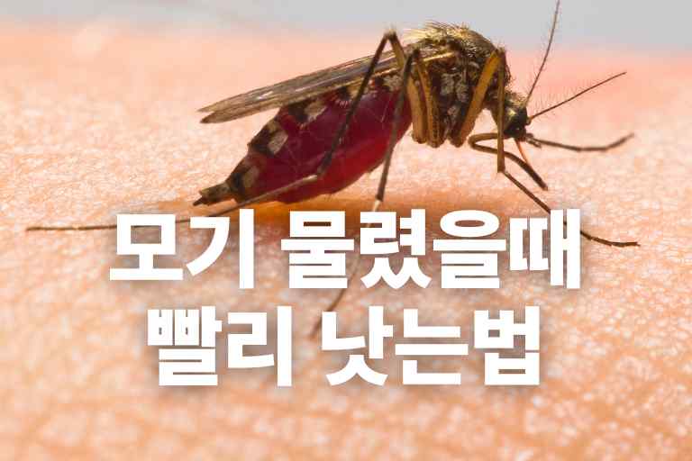 모기 물렸을때 빨리 낫는법